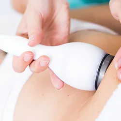 Cryolipolysis – Fat Freeze