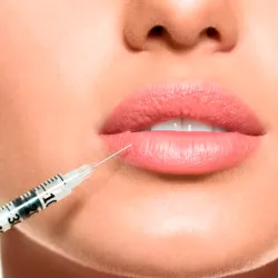 Lip Dermal Filler