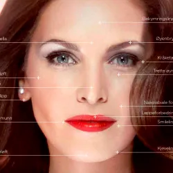 Restylane Vital – Skin Booster