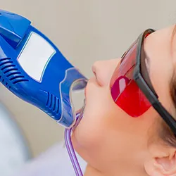 Laser Teeth Whitening