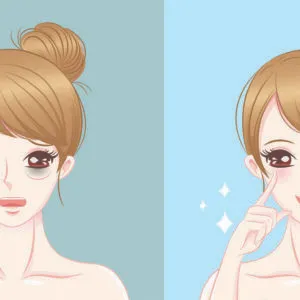 Tear Through Treatment Essex at skinlabbeautyclinic.com Hornchurch UK
