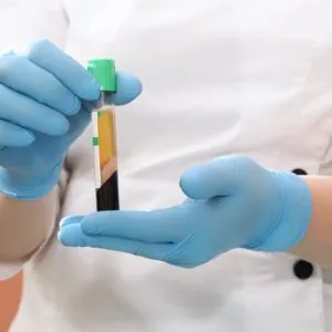 Prp Treatment at skinlabbeautyclinic.com Hornchurch UK