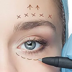 Full Face Baby Botox