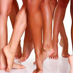 Calf Reduction