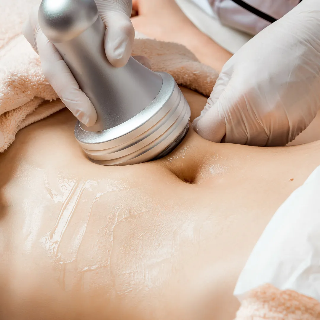 Ultrasonic Cavitation