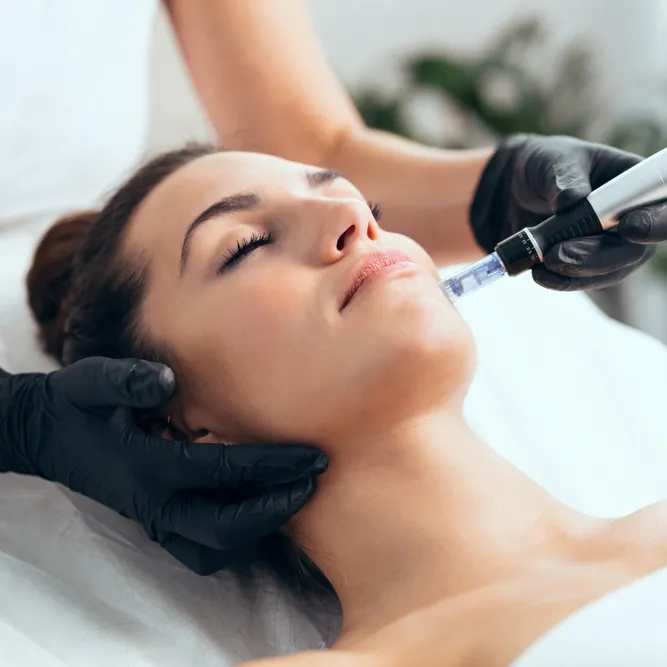 Dermapen – Anti aging