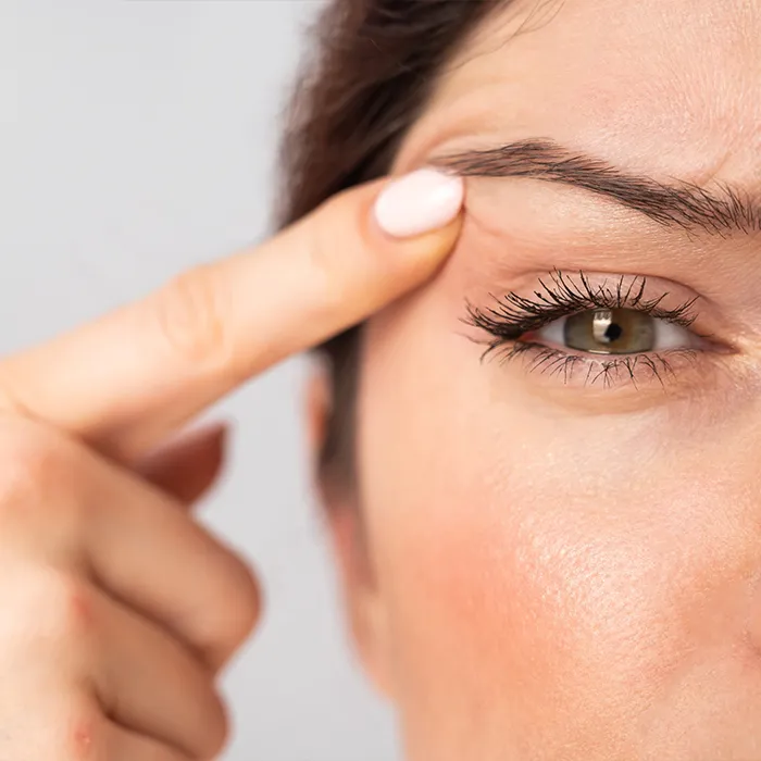 Upper Eye Filler