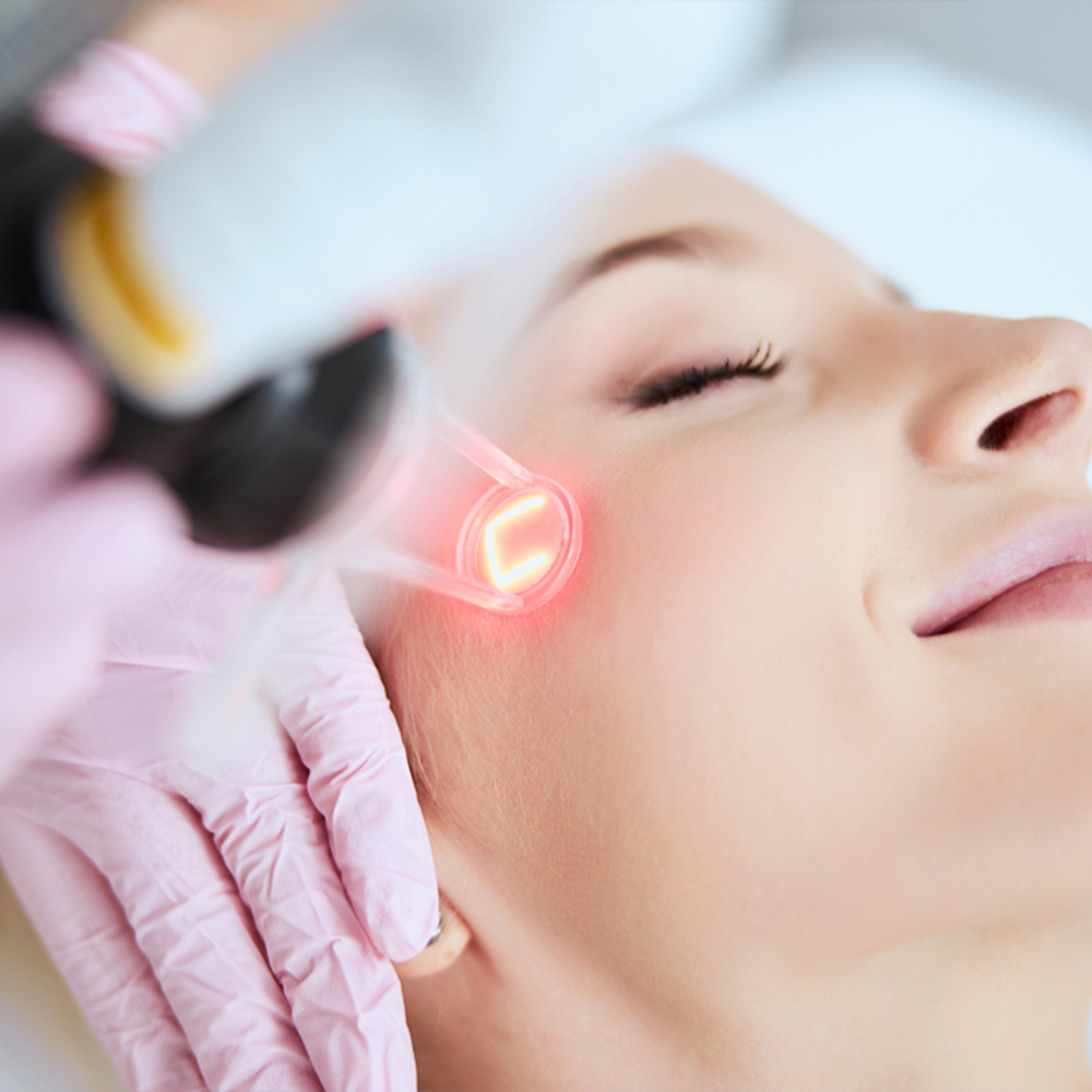 CO₂ Laser (Face, Neck, Stomach, etc.)