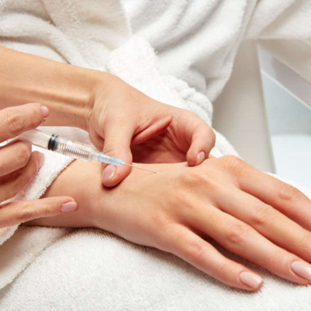 Hand Rejuvenation with Dermal Fillers