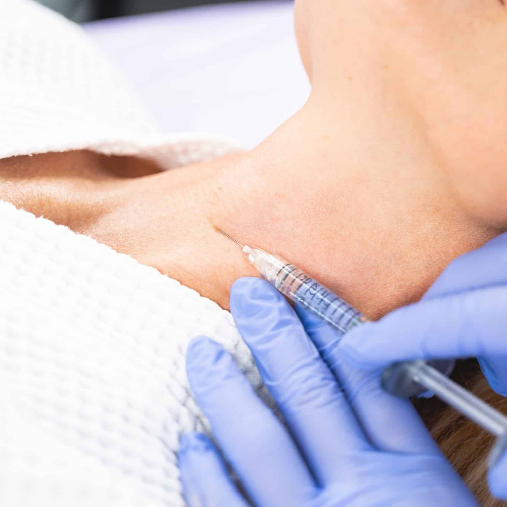 Neck Line Treatments with Dermal Fillers