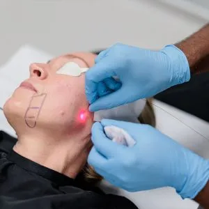 Endolift2 at skinlabbeautyclinic.com Hornchurch UK