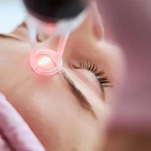 CO2 Laser at skinlabbeautyclinic.com Hornchurch UK