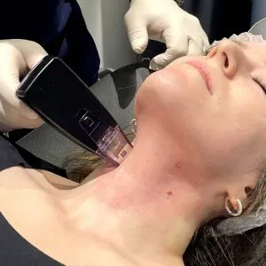Morph at skinlabbeautyclinic.com Hornchurch UK