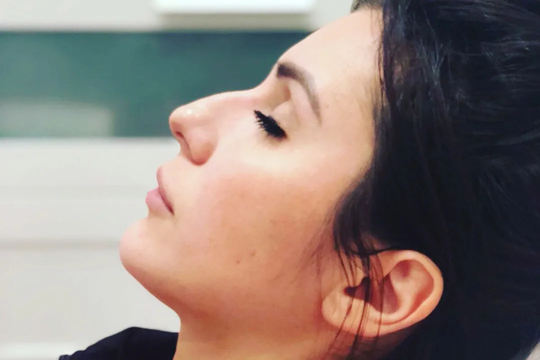Before-Liquid Rhinoplasty